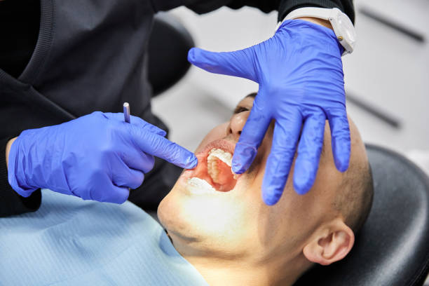 Best Broken or Cracked Tooth Emergency Dentist in Greenville, AL